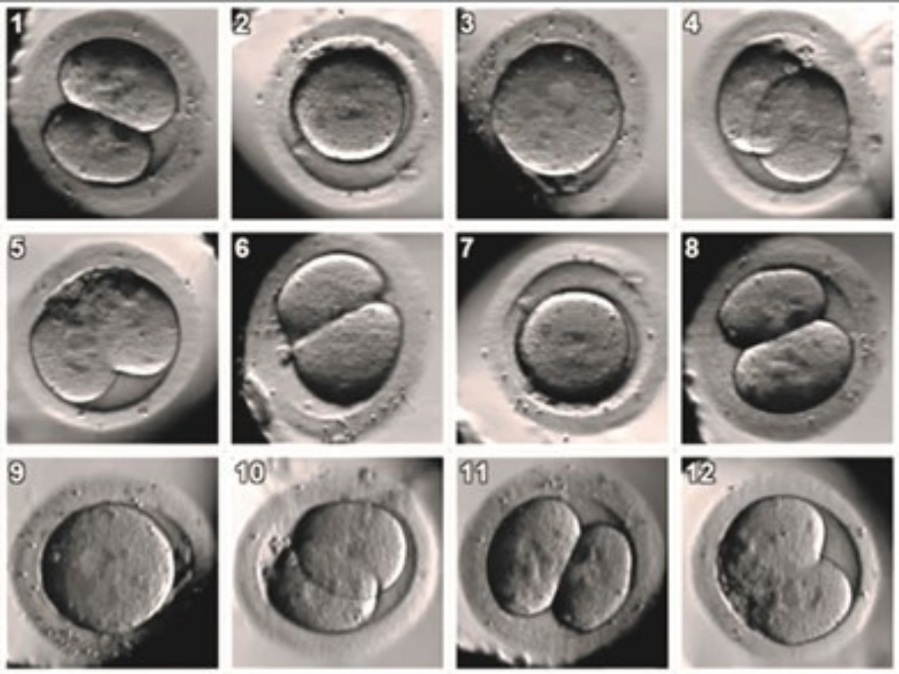 embryo freezing Sunfert International